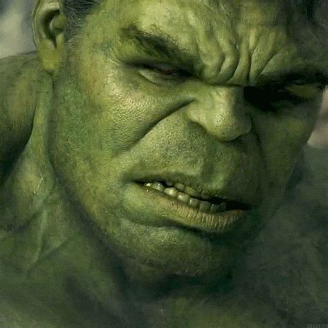 Hulk Smile Hulk Smile: A Comprehensive Guide To The Causes